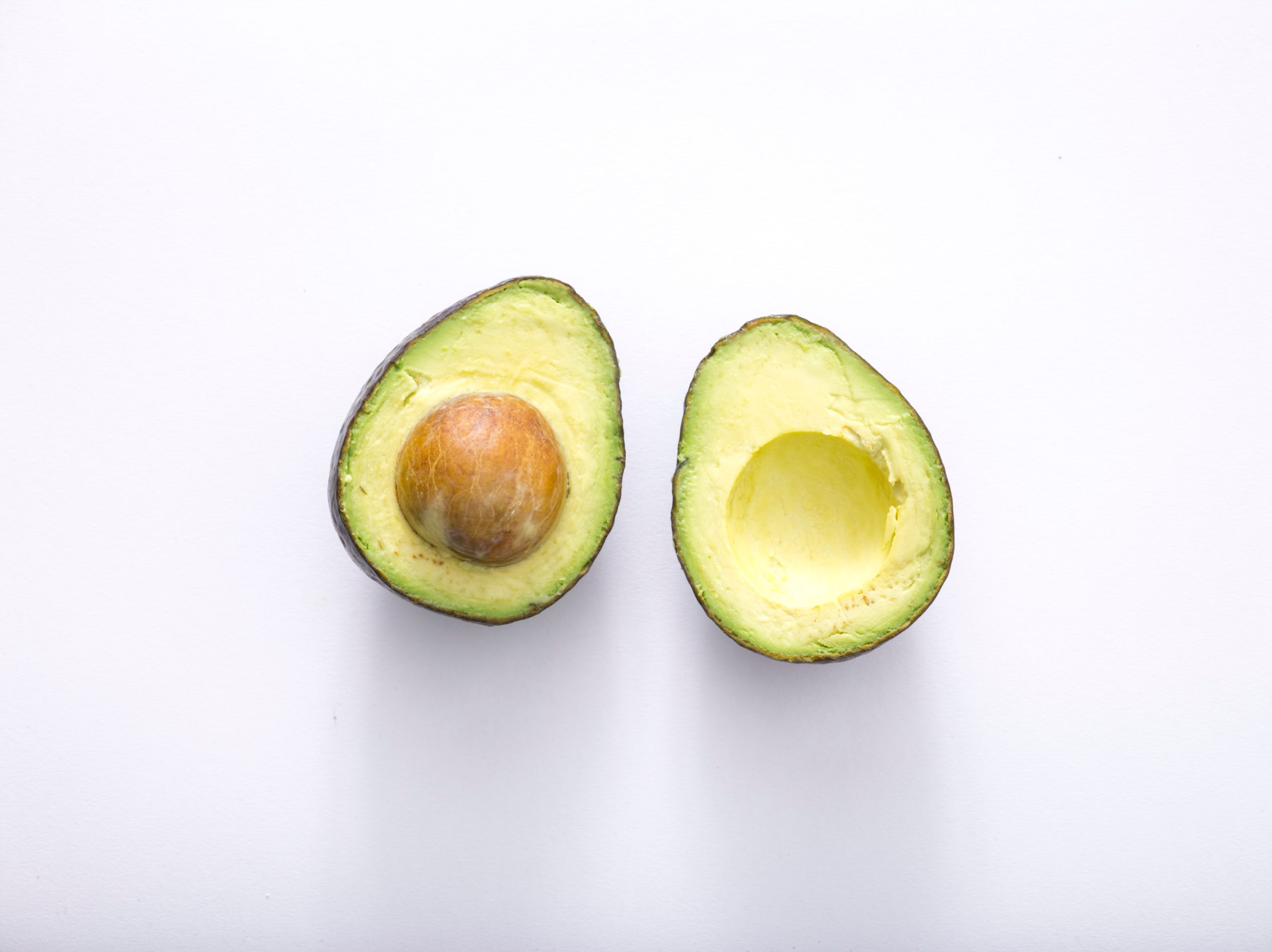 Avocado contain Magnesium