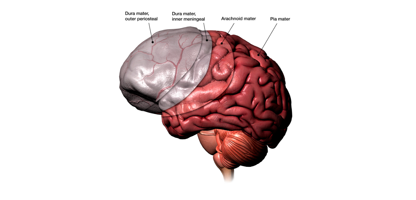 Bacterial Meningitis